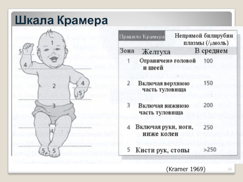 Норма билирубина у новорожденных: причины повышения, расшифровка анализа, 3 совета родителям после выписки