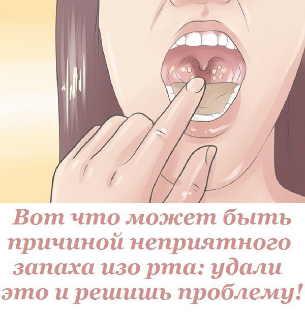 Что делать, если у ребёнка неприятный запах изо рта