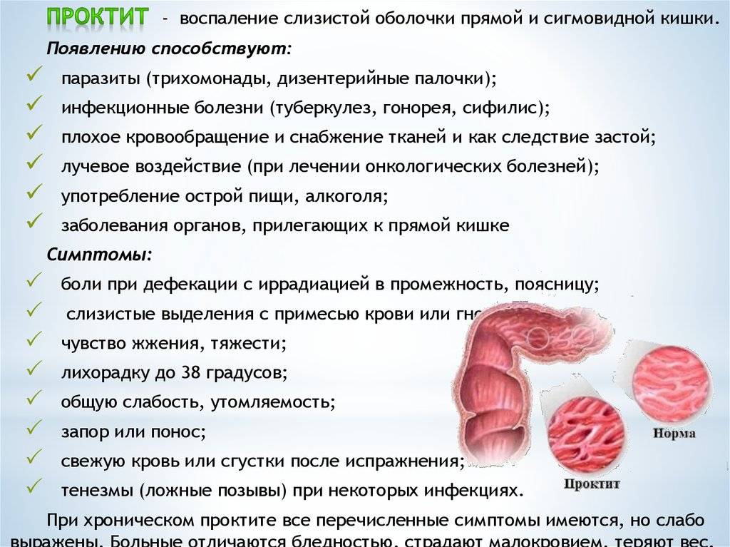 Какие симптомы воспаления кишечника у женщин