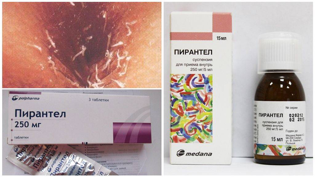 Лечение остриц у кормящей мамы
