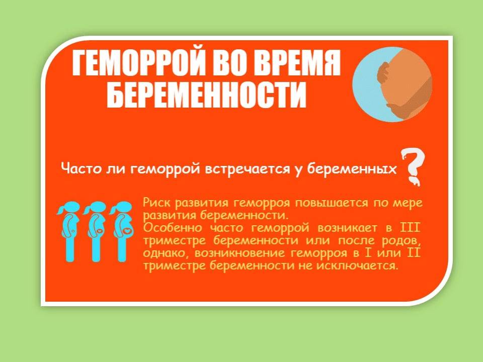 Геморрой у беременных