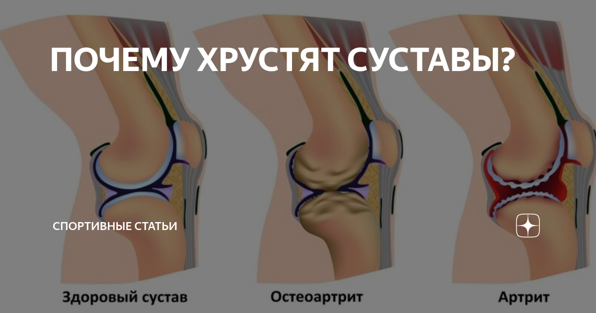 Почему хрустят суставы у детей и подростков: диагностика и лечение