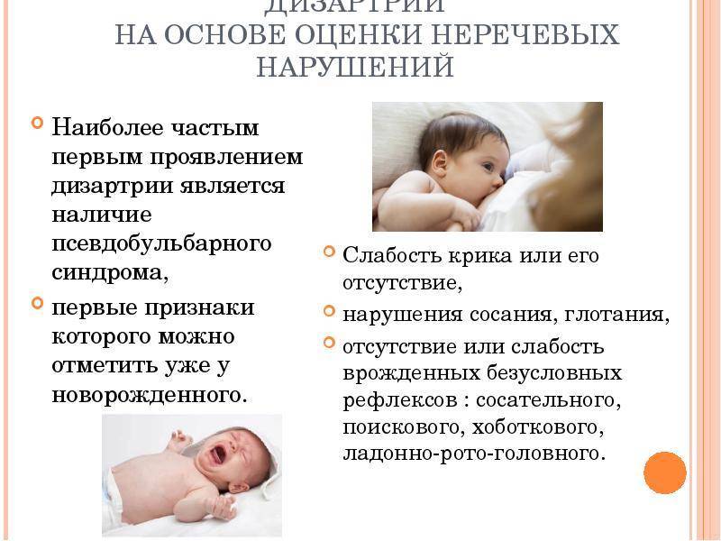 Как распознать дцп у ребенка? | здоровье | аиф югра