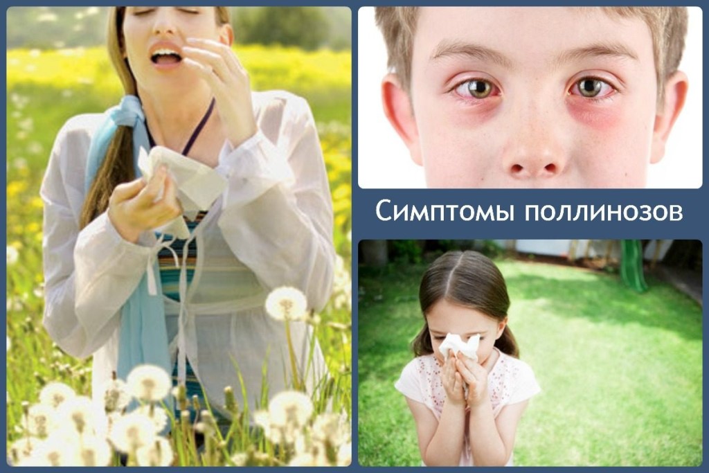 Поллиноз - симптомы, причины, профилактика и лечение