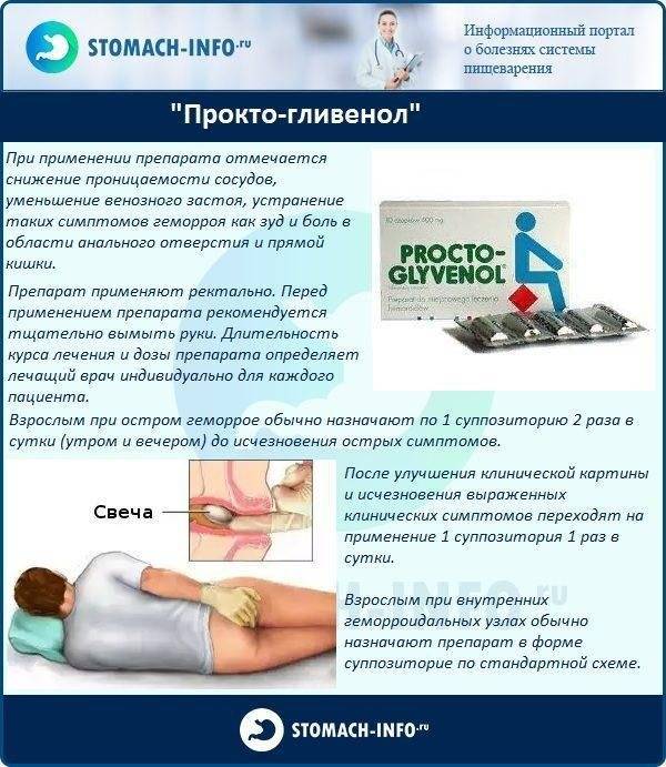 Симптомы геморроя на разных сроках беременности, лечение и профилактика