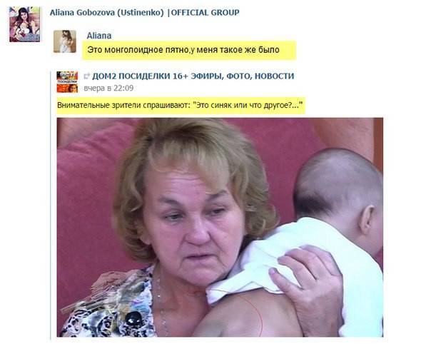 Монгольское пятно — причины, симптомы и лечение