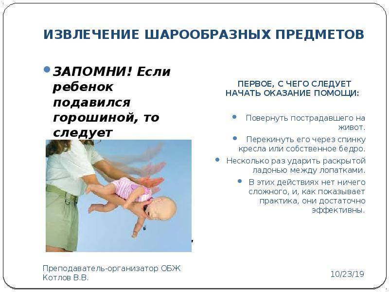 Что делать, если ребенок подавился
