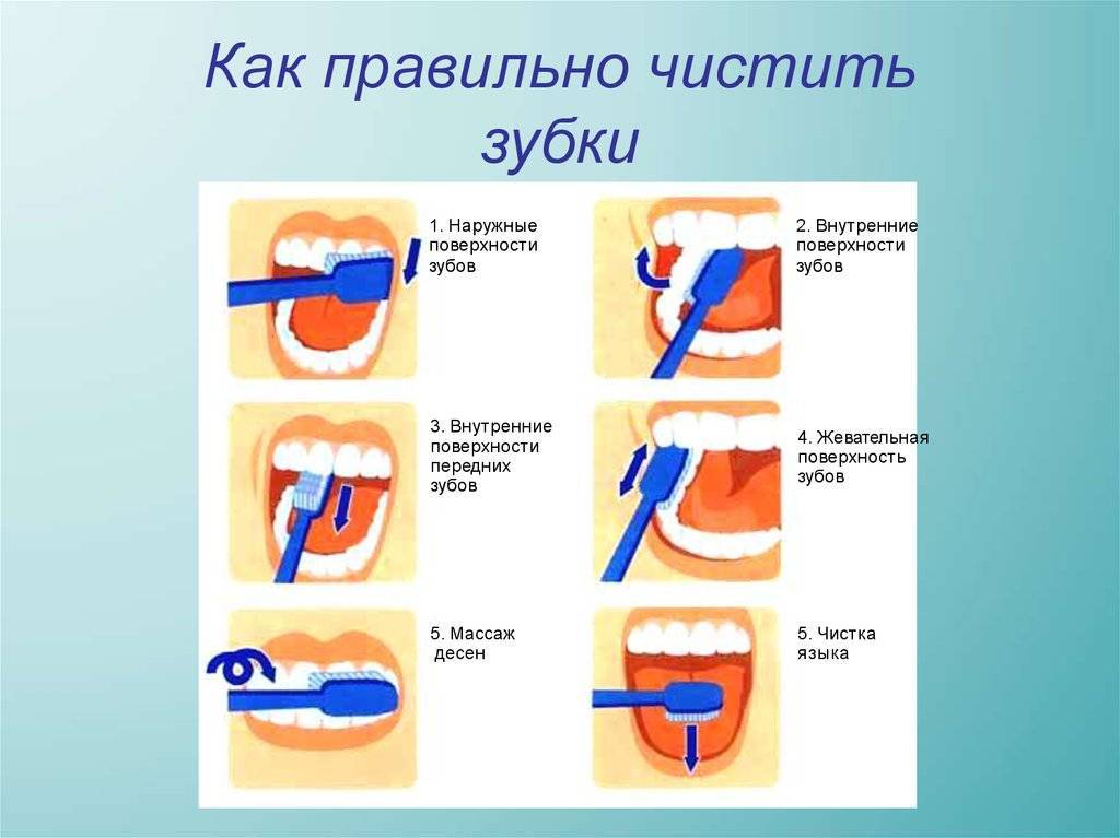 Как приучить ребёнка чистить зубы (в год, 1,5, 2 и 3 года), видео комаровский