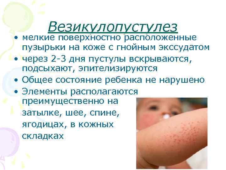 Что делать, если появились высыпания на коже младенца? | детская городская поликлиника № 32