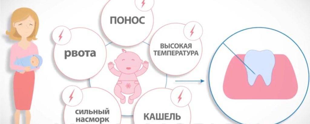 Понос при прорезывании зубов у детей: сколько дней держится жидкий стул, что советует комаровский?