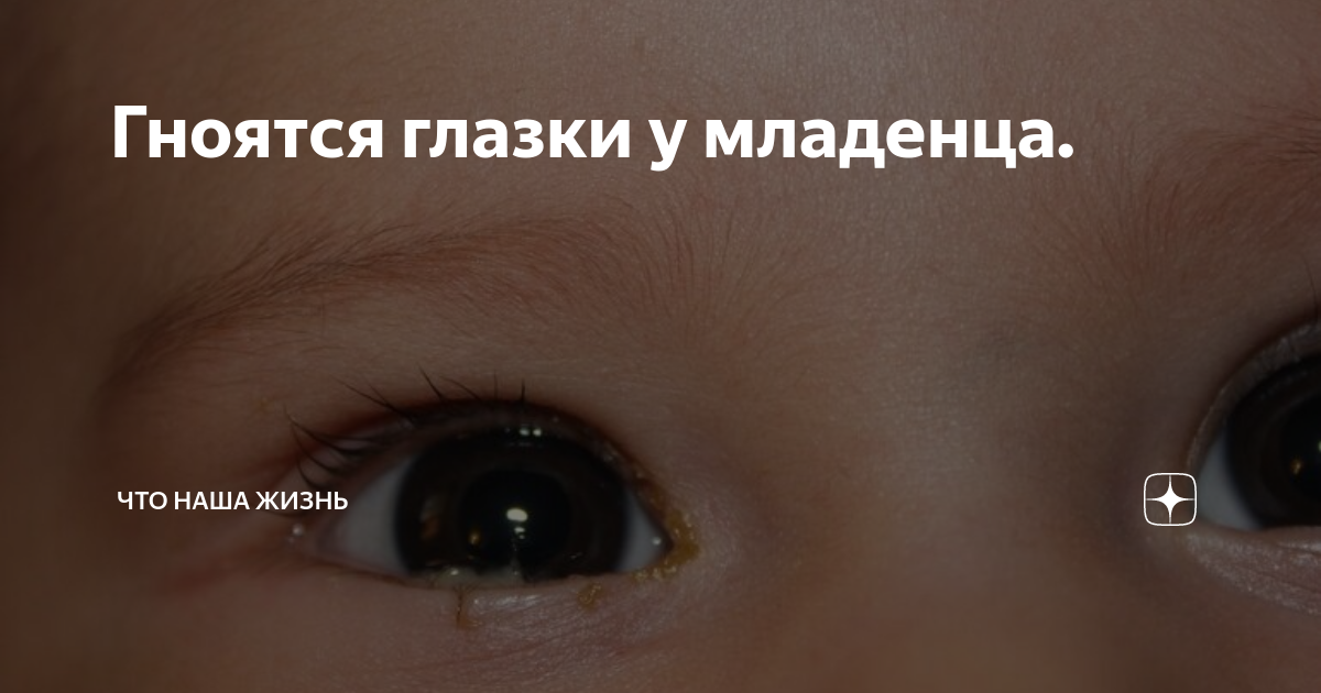 У грудничка гноится глазик: что делать, если у ребенка закисает глаз
