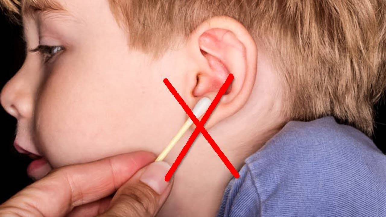 Почему серные пробки в ушах. Серная пробка в ухе у ребенка.