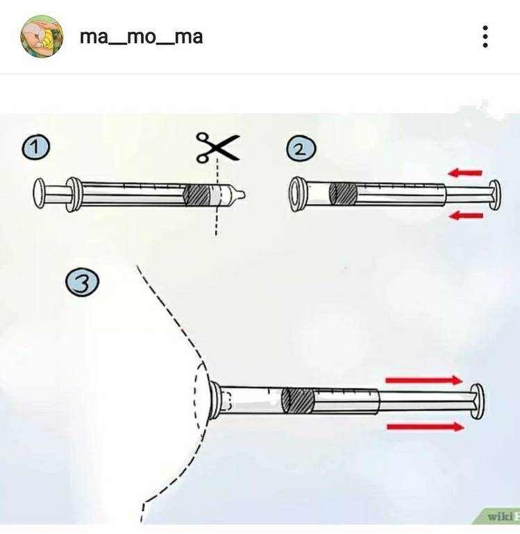 Втянулся сосок. Шприц для вытягивания сосков. Шприц для втянутых сосков. Плоский сосок.