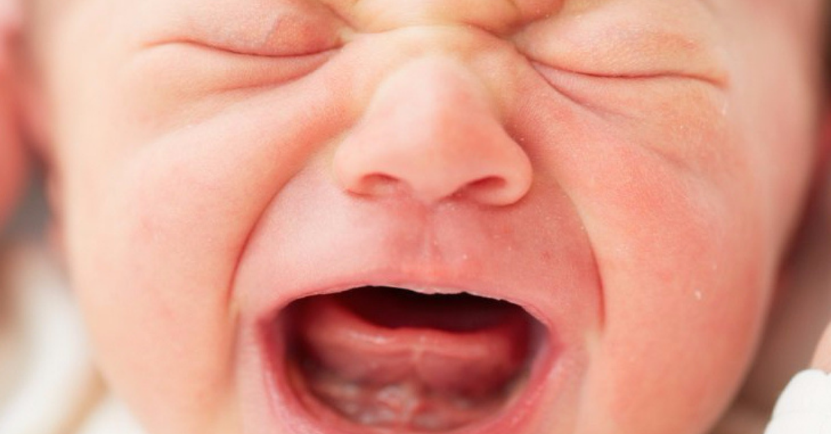 Как определить короткую уздечку языка у новорожденного ребенка: фото