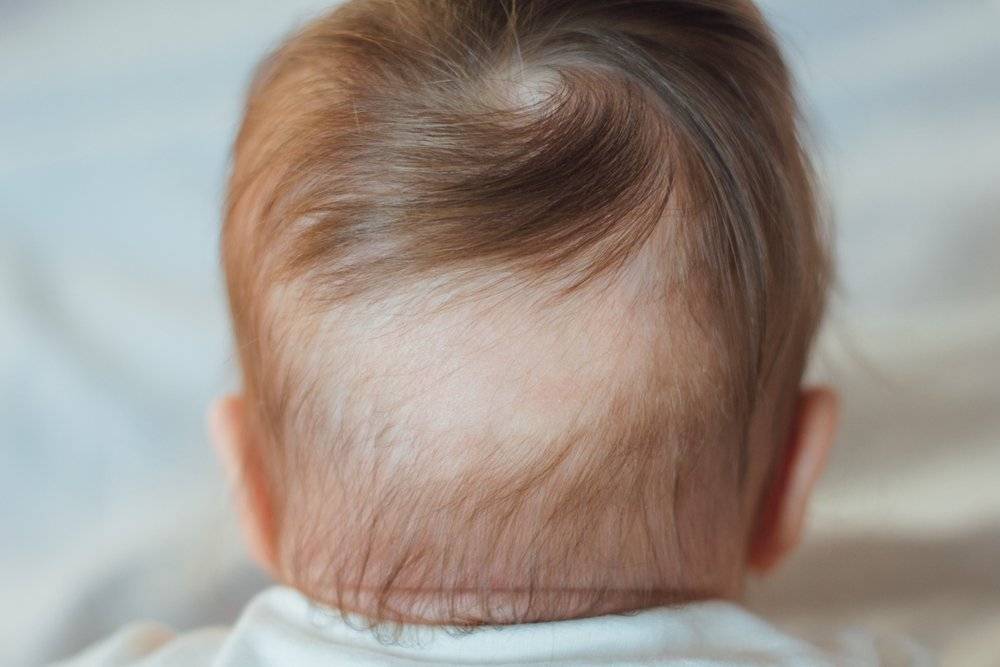 Почему у грудничка в 3­­–4 месяца выпадают волосы на голове и затылке