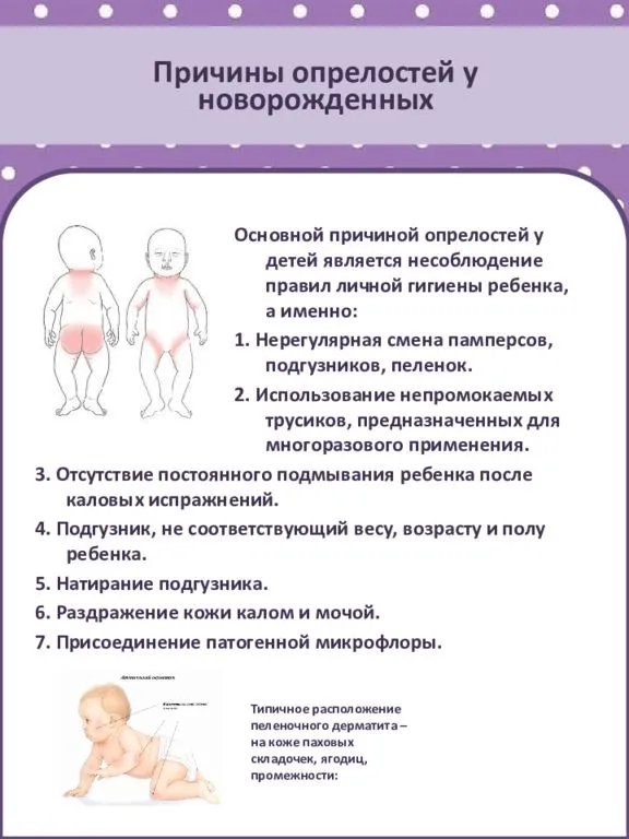 Пеленочный дерматит