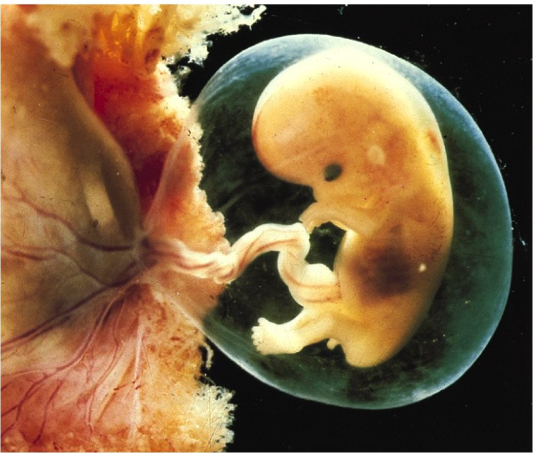 Эмбрион на 7 акушерской неделе беременности. Ребёнок на 7 неделе беременности. Плод на 10 неделе беременности. Ребенок на 6-7 недели беременности. 8 недель тошнота