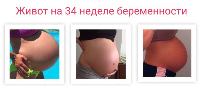 Тридцать четвертая  неделя беременности