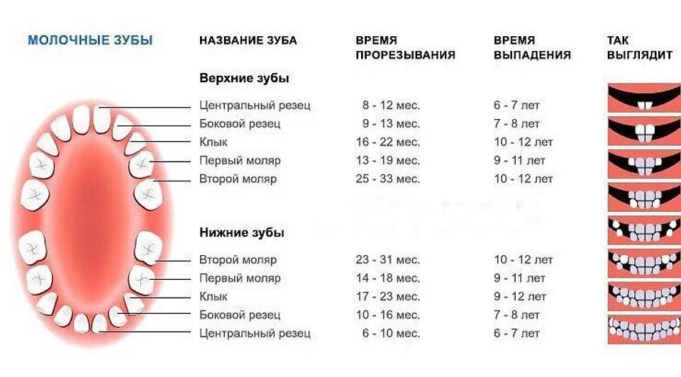 Молочные зубы у детей: схема выпадения и замены на коренные