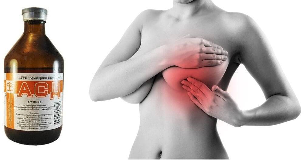 Что делать, если кормящая женщина застудила грудь: симптомы и лечение проблемы
