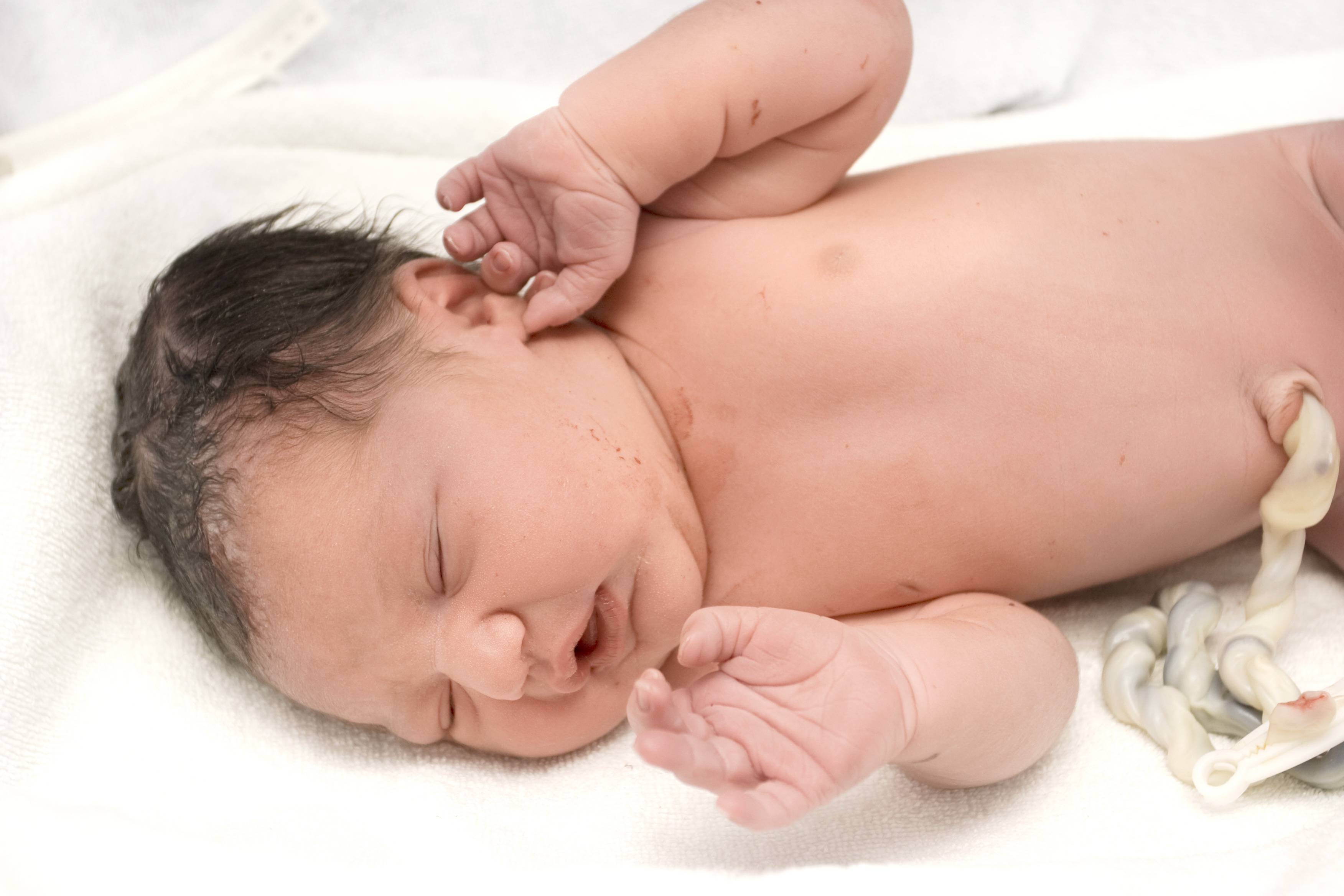 Лечение пупочной грыжи у новорожденных в домашних условиях