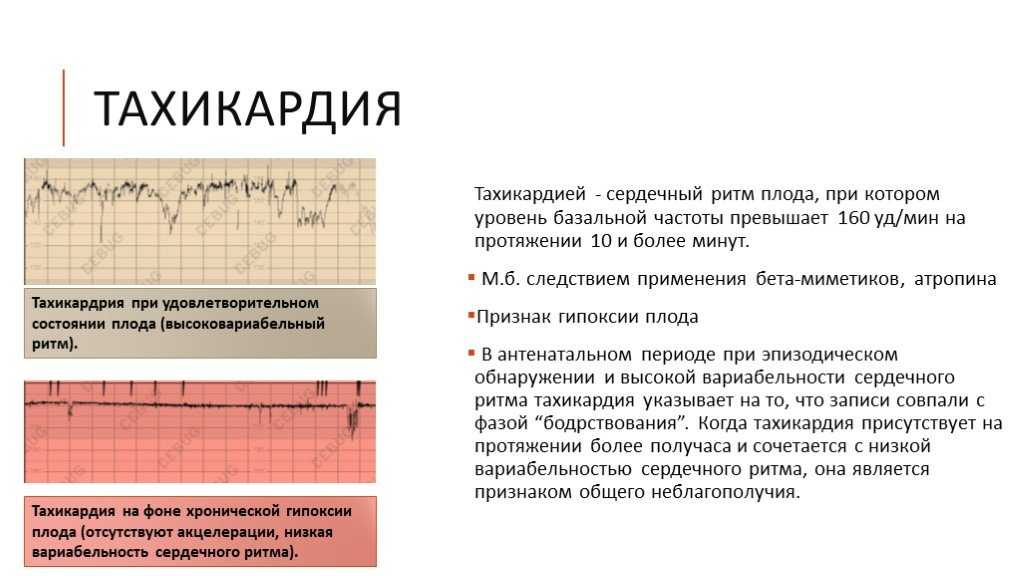 Какова норма пульса у беременных в 1, 2, 3 триместрах беременности?