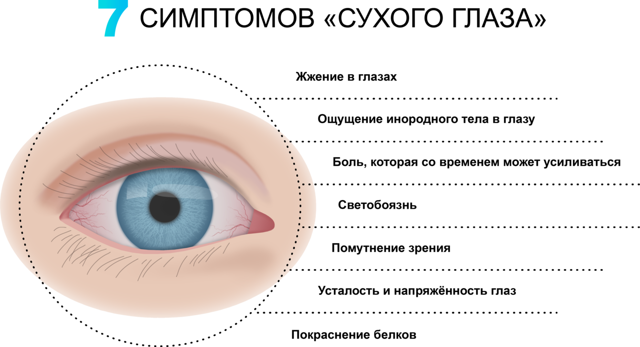 Причины развития синдрома сухого глаза. ССГ (синдром сухого глаза. Синдром сухого глаза профилактика. Причины возникновения синдрома сухого глаза. Почему увеличивается глаза