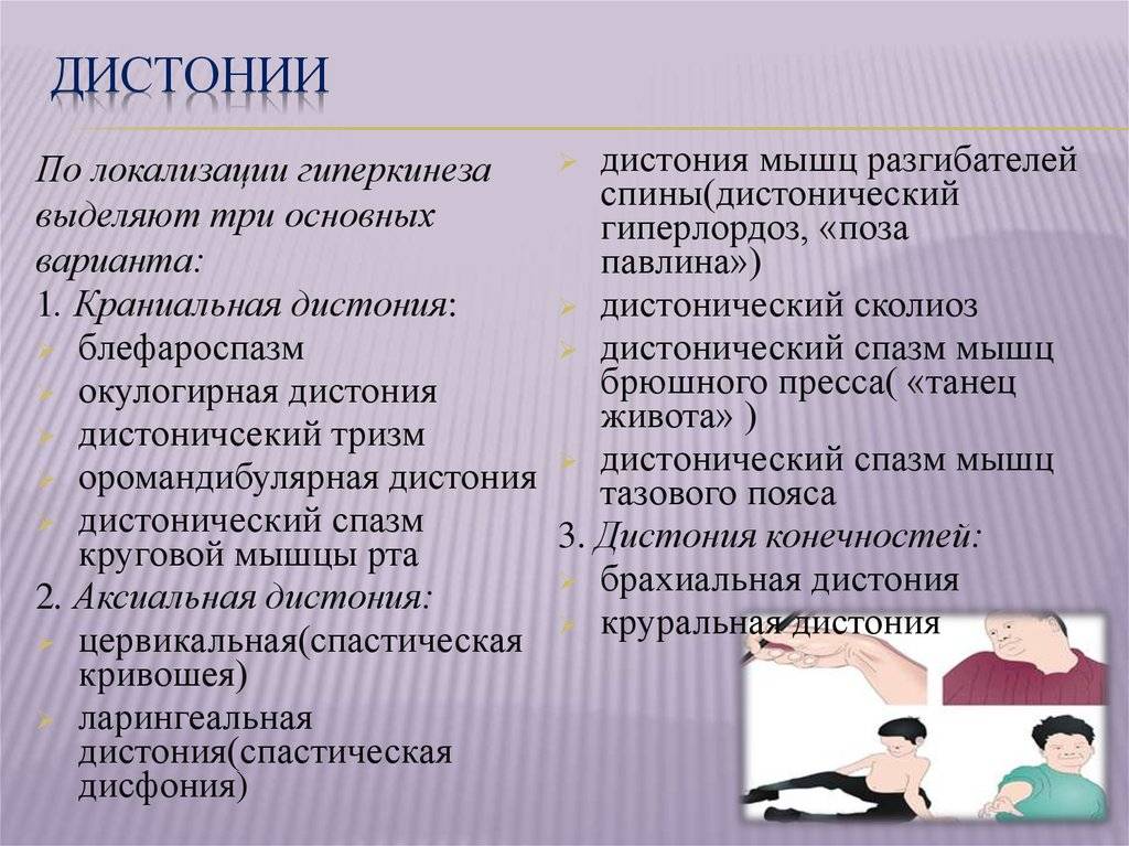 Синдром мышечной дистонии у новорожденных детей: причины нарушения, симптомы и лечение | eskulap-kazan.ru