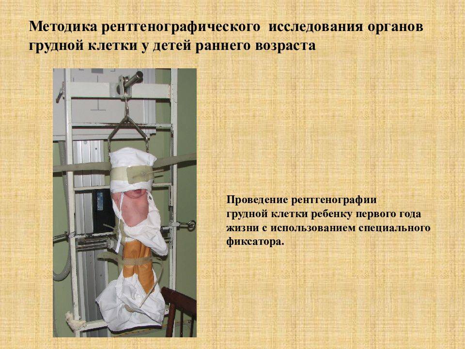 Как делать рентген грудной клетки новорожденному ребенку
