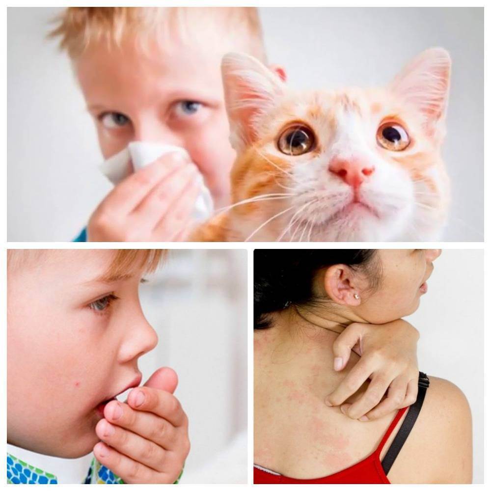 Аллергия на кошек у детей: как проявляется, симптомы аллергии