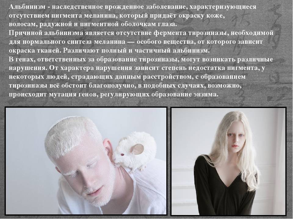 Альбинос: кто такой, 3 типа альбинизма, способы лечения, советы, видео