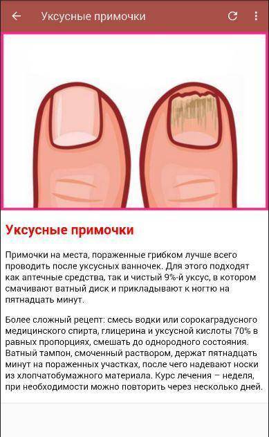 Можно ли красить ногти гель лаком во время грудного вскармливания