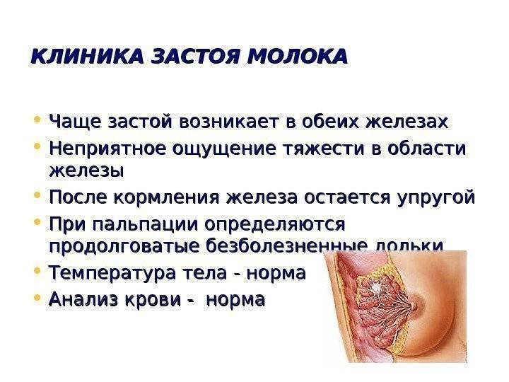 Заболевания молочной железы. лактостаз