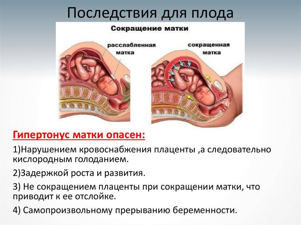 Тонус матки - так ли страшно? | sun flower family