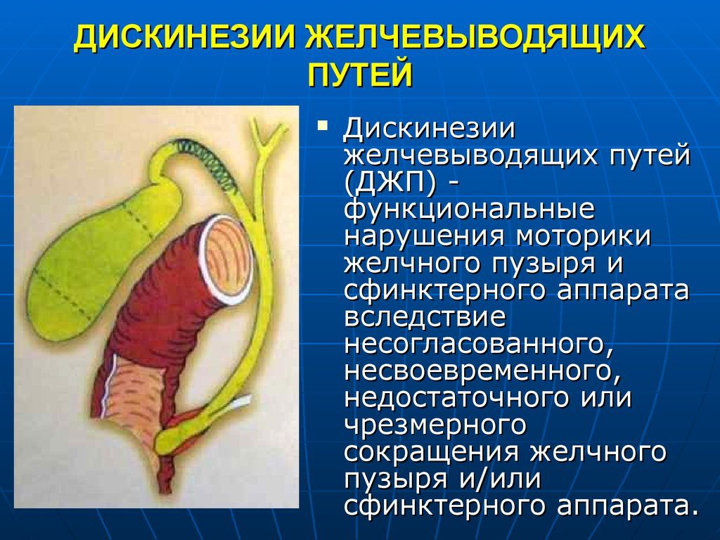Дискинезия желчевыводящих путей у детей: 4 причины, симптомы, 3 пути лечения
