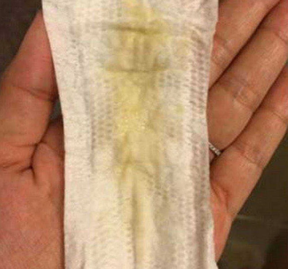 желтые выделения оргазм при беременности (120) фото