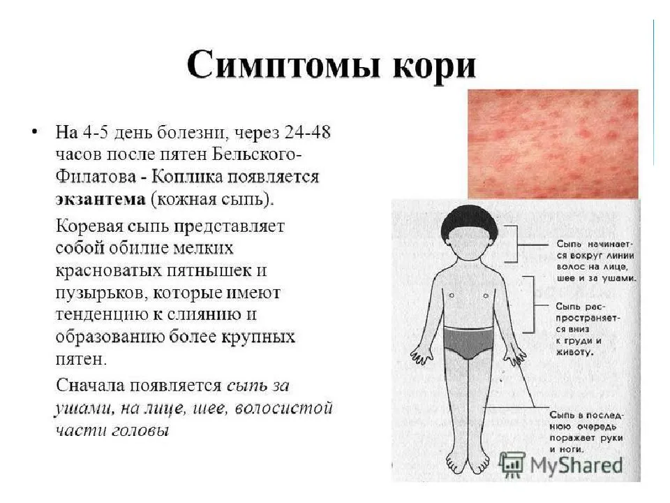 Сыпь на животе и спине у ребенка: без температуры, не чешется, фото с пояснениями
