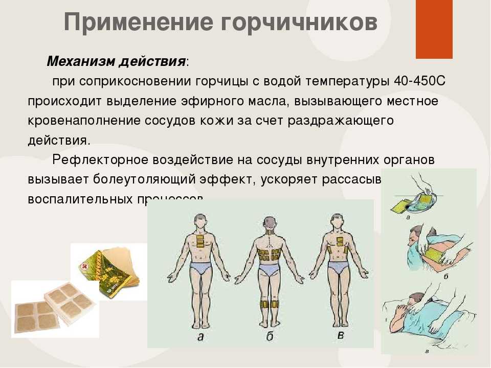 Можно ли ставить горчичники беременным? за и против - spuzom.com