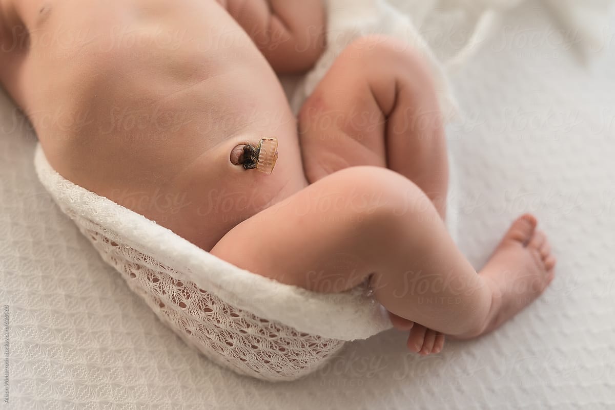 Кровит пупок у новорожденного | уроки для мам