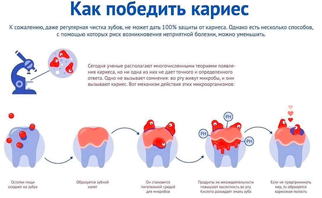 Можно беременным удалять зубы. Профилактика кариеса зубов. Кариес профилактика кариеса. Профилактика кариеса у детей.