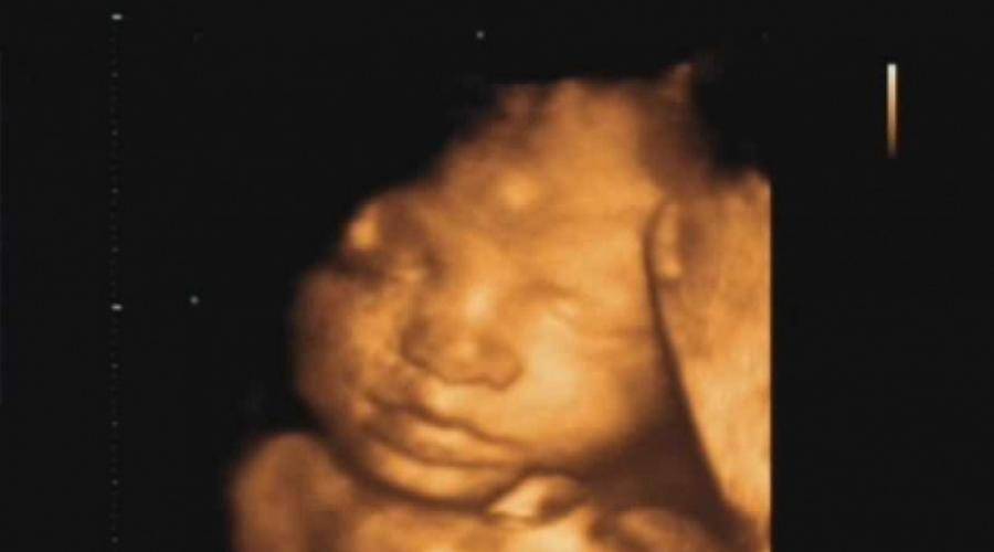 Беременность 21 22. УЗИ плода на 22 неделе беременности. УЗИ ребенка на 22 неделе беременности. Плод на 22 неделе беременности фото УЗИ. Снимок УЗИ 22 недели беременности.