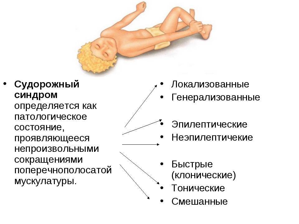 Судороги у новорожденного ребенка: причины, симптомы, последствия и лечение | zaslonovgrad.ru