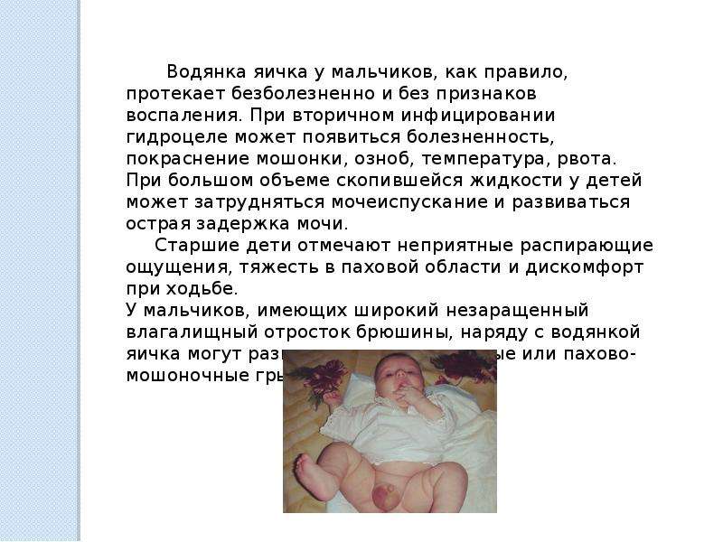 Водянка яичек у малышей - вирилис