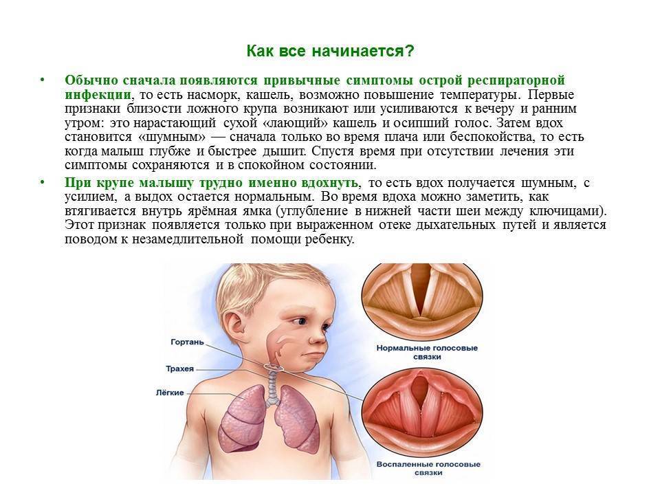 У ребенка хриплый голос и кашель либо у малыша есть хрипы в горле, но он не кашляет: что делать?
