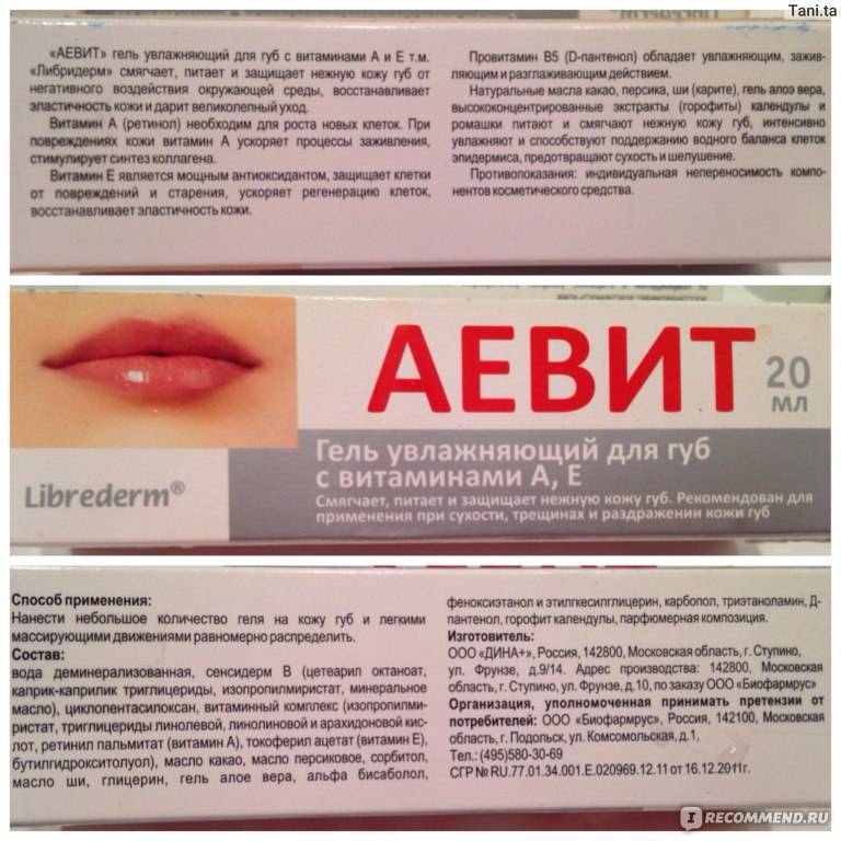 Заеды в уголках рта у детей: причины и лечение, чем можно мазать и как вылечить заболевание