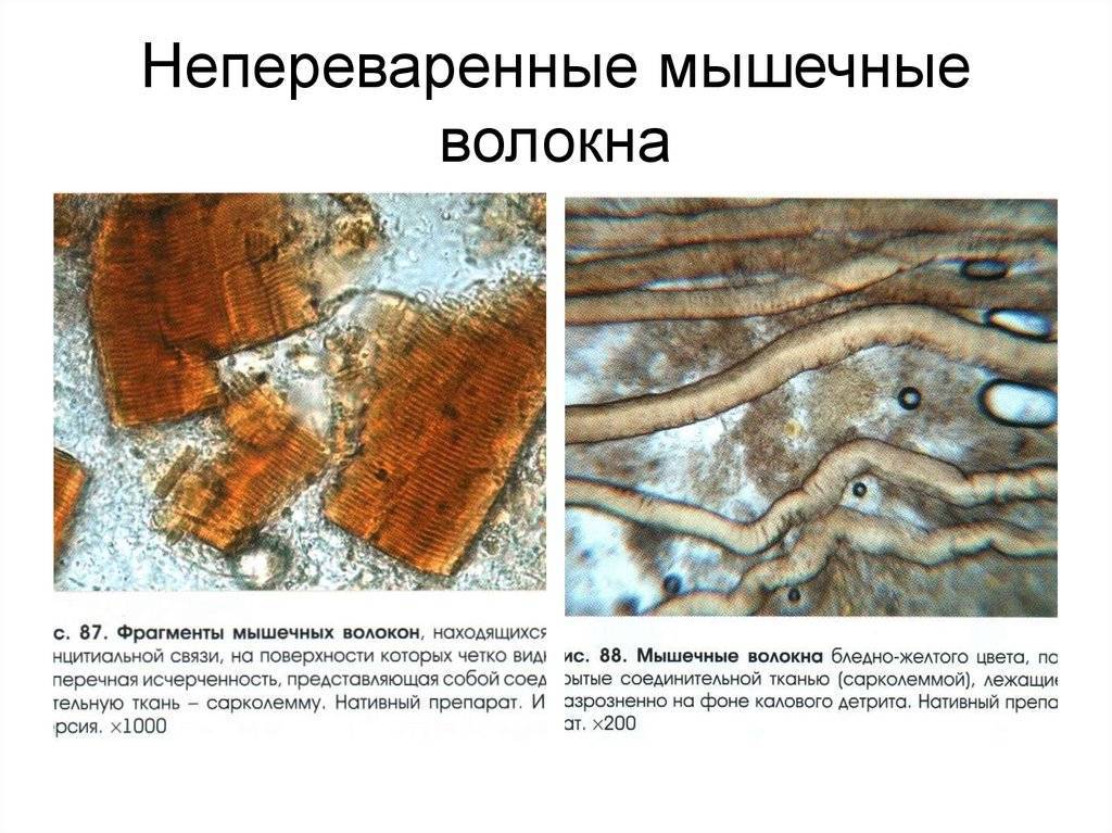 Стул у грудничка на грудном и искусственном вскармливании: какой стул у грудничка считается нормальным?