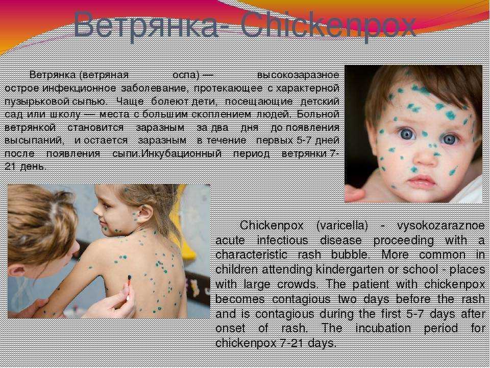 Купание при ветрянке