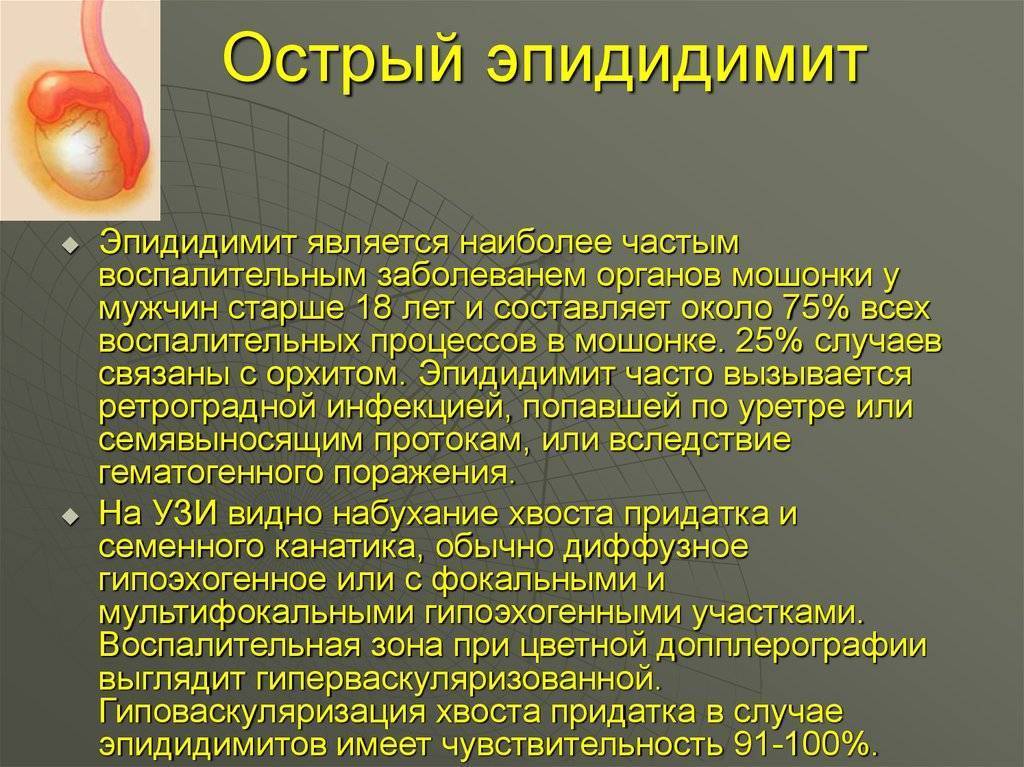 Острые заболевания органов мошонки у детей презентация