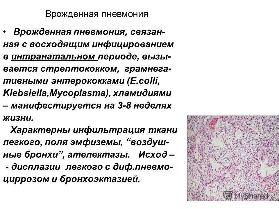 Клебсиелла у грудничка в кале - виды бактерий и влияние палочек на работу кишечника