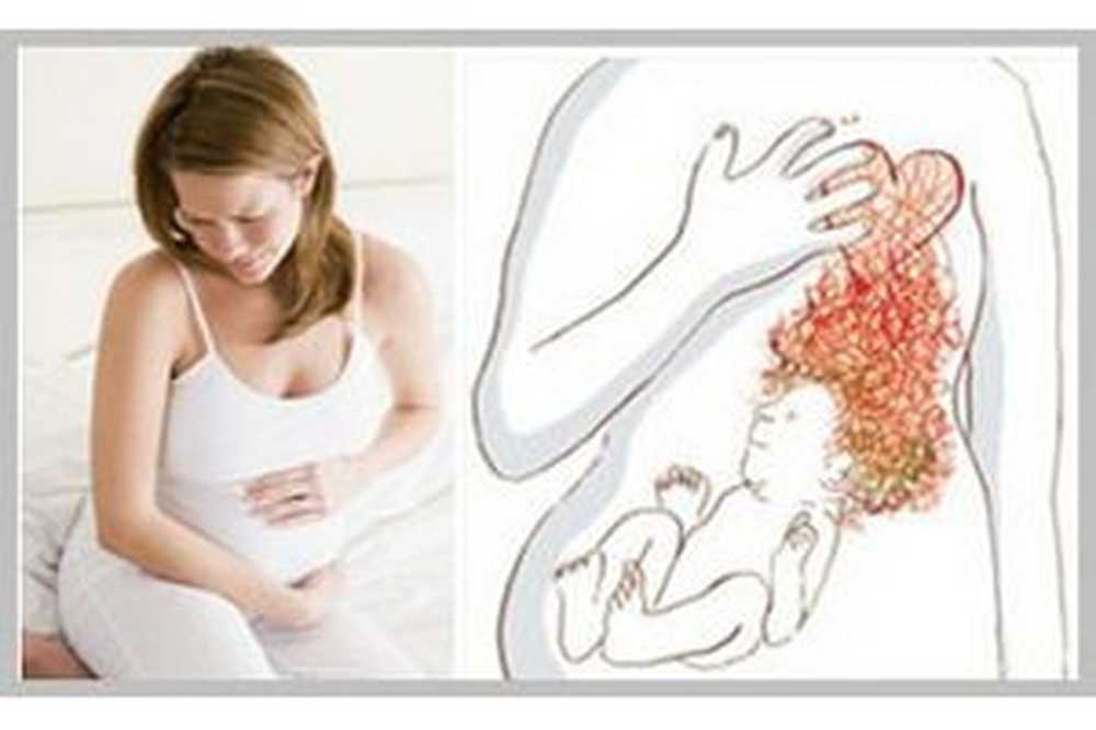 Изжога при беременности во втором. Изжога при беременности первый триместр. Желудок изжога при беременности. При изжоге при беременности. Изжога у беременных на ранних сроках.